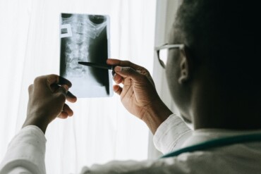 röntgenonderzoeken